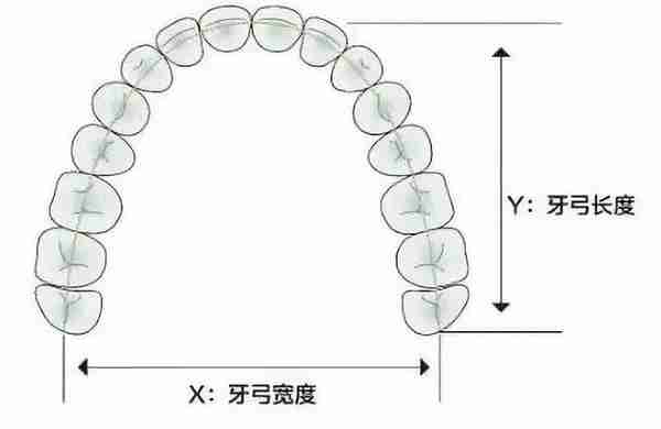 牙齿矫正中的“扩弓”，究竟是什么？