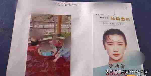 云南22岁少女吸脂死亡，真相是什么？