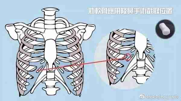 花什么几十万做鼻子？想要隆鼻好看，看完这一篇就够了！